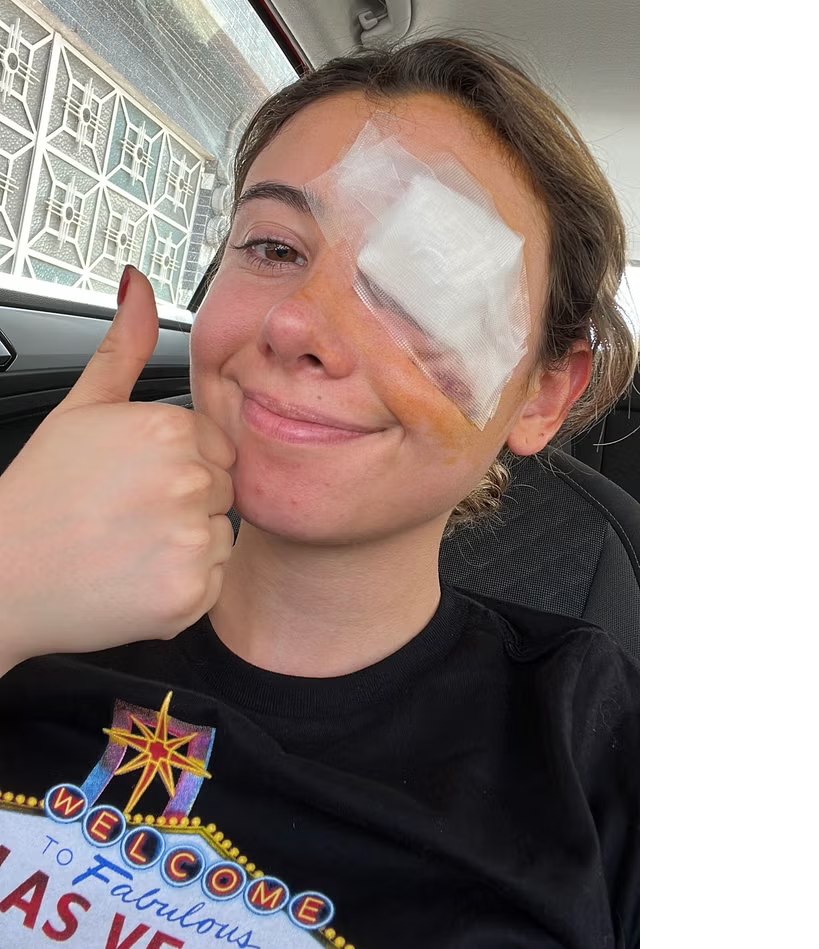 A ajuns la operație după ce s-a demachiat. Coșmarul unei tinere care a apelat la un truc de pe Tik Tok: „Nu a funcționat la mine“