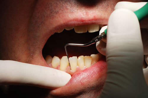 Aproape 2 din 3 români au probleme dentare