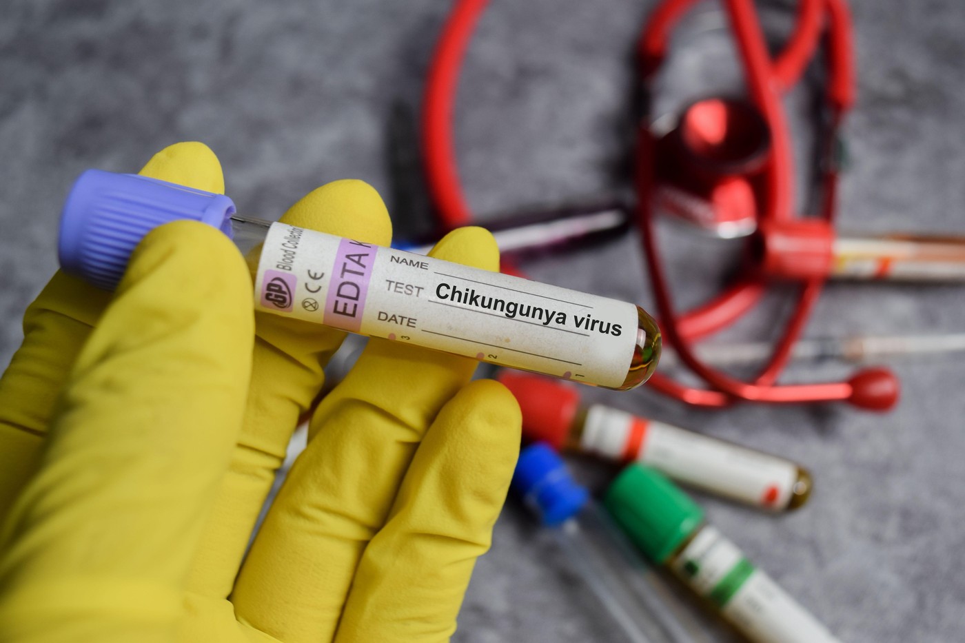 Alertă sanitară în New York. Prezența unui nou virus a fost confirmată de autorități. Cum se transmite și care sunt simptomele Alertă sanitară în New York. Prezența unui nou virus a fost confirmată de autorități. Cum se transmite și care sunt simptomele