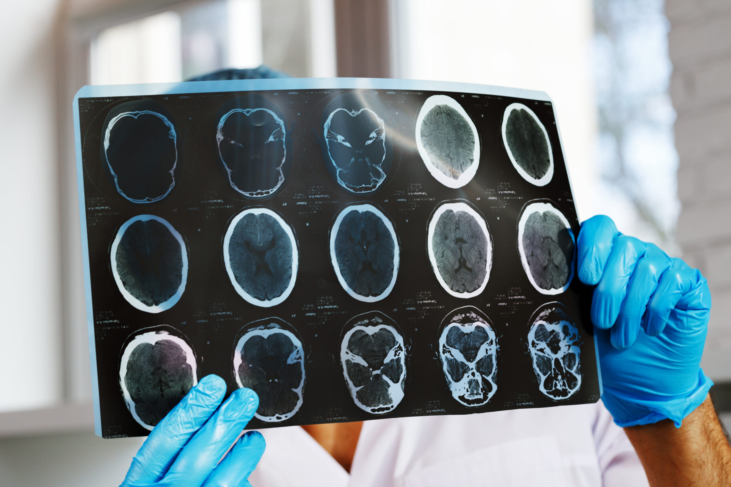 Neurologii vorbesc despre cel mai bun obicei pentru menținerea unei memorii bune după vârsta de 55 de ani. Ce ar trebui să faci zilnic Neurologii vorbesc despre cel mai bun obicei pentru menținerea unei memorii bune după vârsta de 55 de ani. Ce ar trebui să faci zilnic