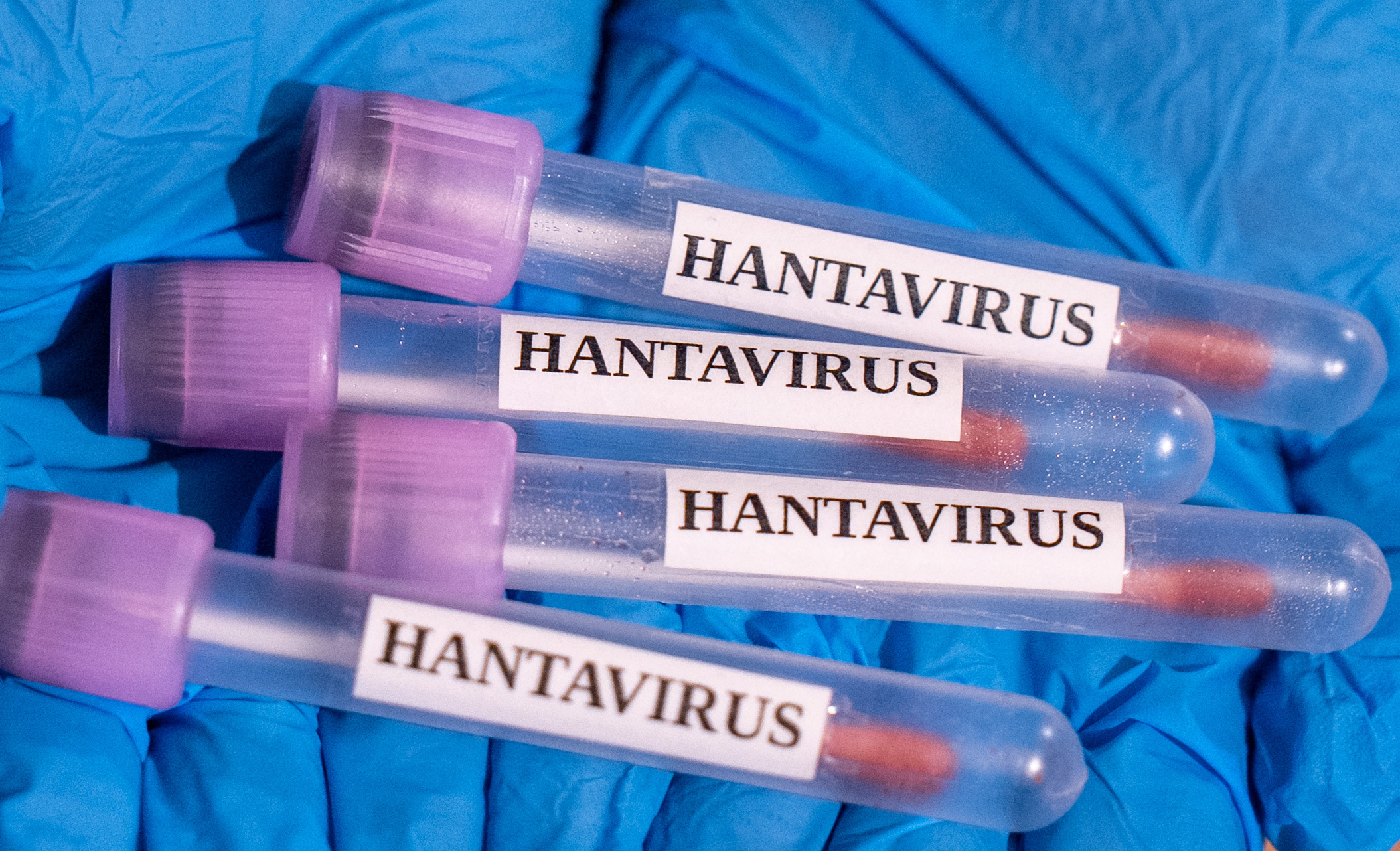 pasagerii de pe nava de croazieră MV Hondius afectată de hantavirus sunt considerați „contacte cu risc ridicat” și vor fi monitorizați 42 de zile