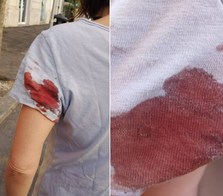 Atac armat pe o stradă din Roma. O jurnalistă a fost împușcată de un individ care ar viza femeile Atac armat pe o stradă din Roma. O jurnalistă a fost împușcată de un individ care ar viza femeile